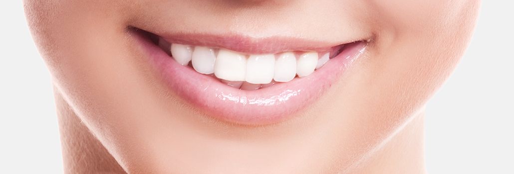 Nahaufnahme eines weißen Zahnlächelns nach der Zahnaufhellung