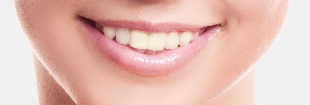 Nahaufnahme eines natürlichen Zahnlächelns vor der Zahnaufhellung